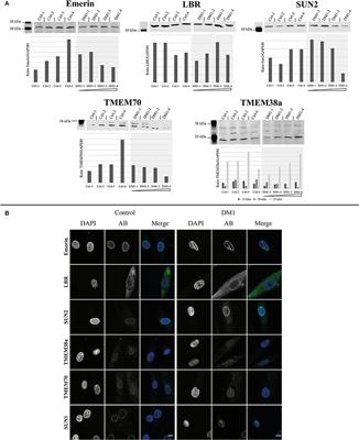 Nuclear Envelope Transmembrane Proteins in Myotonic Dystrophy Type 1